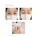 역삼-1293 | 강남 속눈썹펌 :: 채아뷰티 - 케라틴 클리닉 속눈썹펌 후기