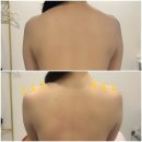 (유)길은 | 동래피부관리 잘하는 &#34;오브유스킨&#34; 바디관리 재방문 후기 🔥