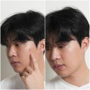 얼굴좁쌀여드름 볼좁쌀여드름 피부관리방법 피지웰 글로우 케어 부스터