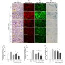 전신 걷기 운동 노르딕 워킹 | 당뇨 노르딕워킹 하루 30분씩 8주 했더니 당화혈색소 7.6에서 6.3 됐어요
