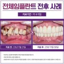 선유도역 임플란트 전문 치과 잘하는 곳 후기 좋은곳 추천 6곳