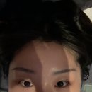 브이빔 레이저 5회차 후기 | 스타워커 레이저 | 내돈내산 전후비교 후기 포함
