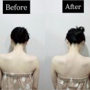 장승배기한의원 | [서울 상도] 숲칼프 장승배기점 ㅣ상도동 두피&amp;피부 관리 동시에