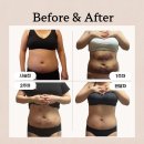 멍타주 | 천호 복부 다이어트주사 한달차 후기 총정리! 체지방 -4kg 감량