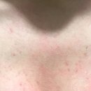 쇼킹바(Bar) 이미지