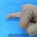 강남챔피언정형외과의원 이미지