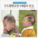 지오크리에이티브호남지사 | [대전지오헬멧] 단두 아기두상교정 4개월차 후기(절망편?..+14개월아기만난 썰)
