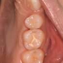 애플치과기공소 이미지