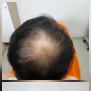 뽀샤시 스킨바디