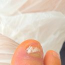 장안약국 | [장한평/장안동] 장안동 무좀발톱 전문케어 &#39;바이오풋케어 장안점&#39;