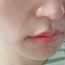 르영