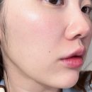 은이샵 | 레이저 시술 후 관리 꿀템! 피부과 재생크림 추천 포스트랩 찐후기