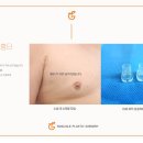 글램성형외과의원 티스토리