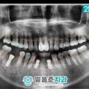 은천동-41 네이버블로그