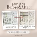 JJ디톡스 | [칼로리바 대구 죽전점]칼로리바 다이어트💪 운동없이 체지방 -1.8kg 감소 후기