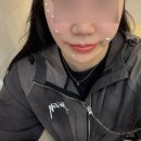 우리맑은의원 | 미아역 우리맑은의원 점빼기 1개당1100원 (평편사마귀 제거 1100원) 찐 후기