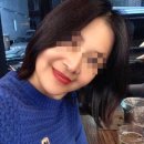 빌리프성형외과의원 | 안면거상술잘하는곳, 논현역 빌리프성형외과 한달차 후기