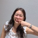 인디언 | 레디어스 팔자, 인디언주름 후기 (쥬베룩, 필러랑 차이점)