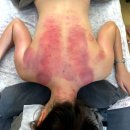 씨유 천안용곡우림필유점 | [천안 용곡동] 어깨&amp;등 통증관리 최고 맛집 &lt;브이라인&gt;