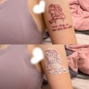 읻다 | [읻다클리닉] 2회차 문신제거 후기