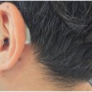 에코보청기 청각난청센터 노원점 이미지