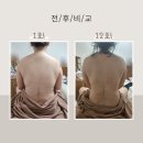 내돈내산 출장 산후마사지 - 미쁨산후케어