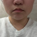 해운대 중동 동물병원(큰마음빌딩) | 부산 해운대 온다리프팅 6만줄 윤곽주사 내돈내산 후기