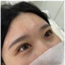 나의속눈썹 이미지