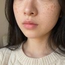 우리힐약국 | 주근깨 지우개 TXA 크림 화장품 약국 연고 비교 후기