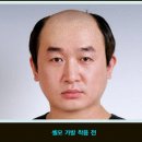셀모가발 이미지