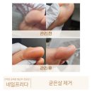 네일프리다 이미지