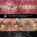 미소디자인치과의원 이미지