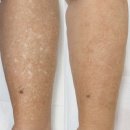 지디메디컬 이미지