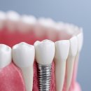 365우리들치과병원 이미지