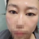 미소피부 운정역점