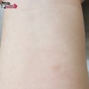메디젤