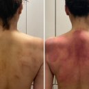 에스테틱 힐링수 이미지