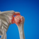 광주탑정형외과의원 이미지