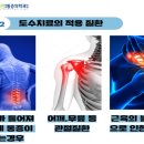 그린통증의학과 네이버블로그