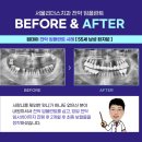풍무치과 네이버블로그