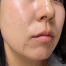 씨유 미사퀸즈파크점 | 하남 미사역 피부관리 잘하는 곳 임쁨 피부 재생관리 턴오버필링 후기