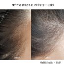 서초두피문신 나니스튜디오 SMP 상담부터 시술 후기까지