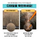 마이크로헤어증모