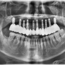 해나루구강악안면외과치과의원 이미지
