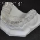 스마일치과기공소 이미지