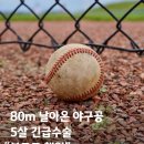 80m 밖에서 날아온 야구공에 두개골 골절된 아이 이미지