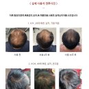 주식회사 탈모연구소