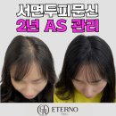 설디자인 | 서면두피문신 에테르노에서 자연스러운 SMP 디자인 상담받은 후기