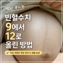 내가 임신후기 때, 빈혈수치 9에서 12로 올린 방법