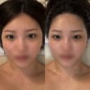 청담맑은에스테틱 | 세종신부관리 오르안 에스테틱 트리플 3콤보하고 온 솔직 후기!